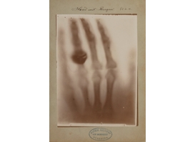 Logo_oudste_r_ntgenfoto_ter_wereld__foto_van_hand_bertha_r_ntgen__beeld_via_persbericht_teylers_museum_